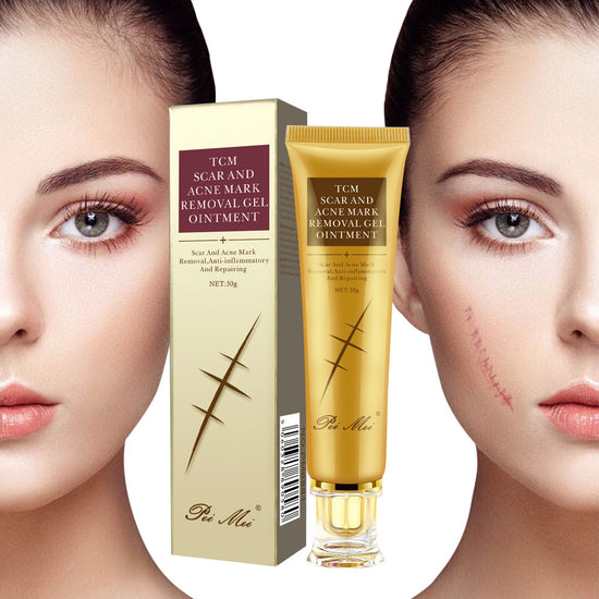 Scar Removal Cream